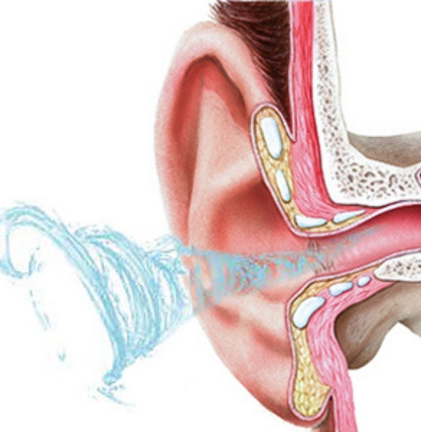 Ear Washer: image 2