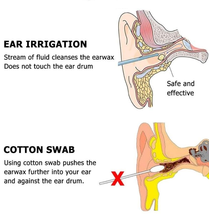 earwax clean system online